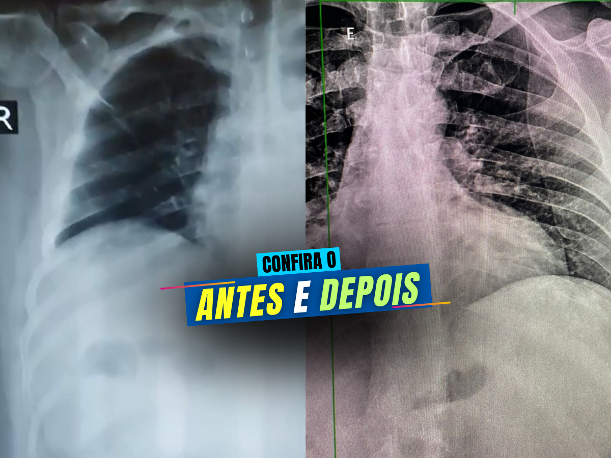 ANTES